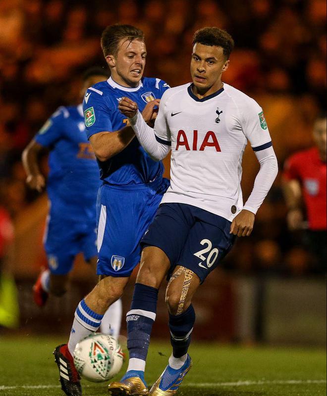 混团世界杯爆大冷！日本一哥被爆冷，张本美和剃光头，国乒打硬战（混团世界杯大冷门：日本一哥出局，张本美和剃发立志，国乒鏖战过关）